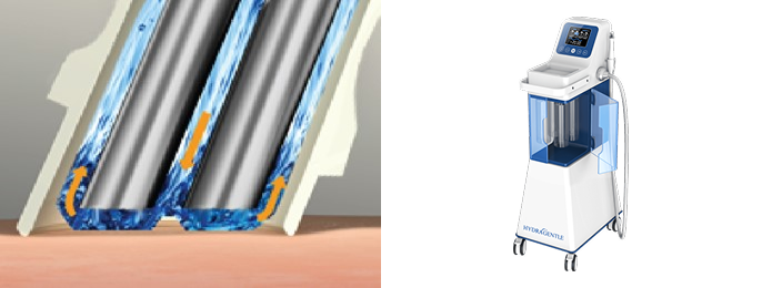 ハイドラ吸引のイメージ