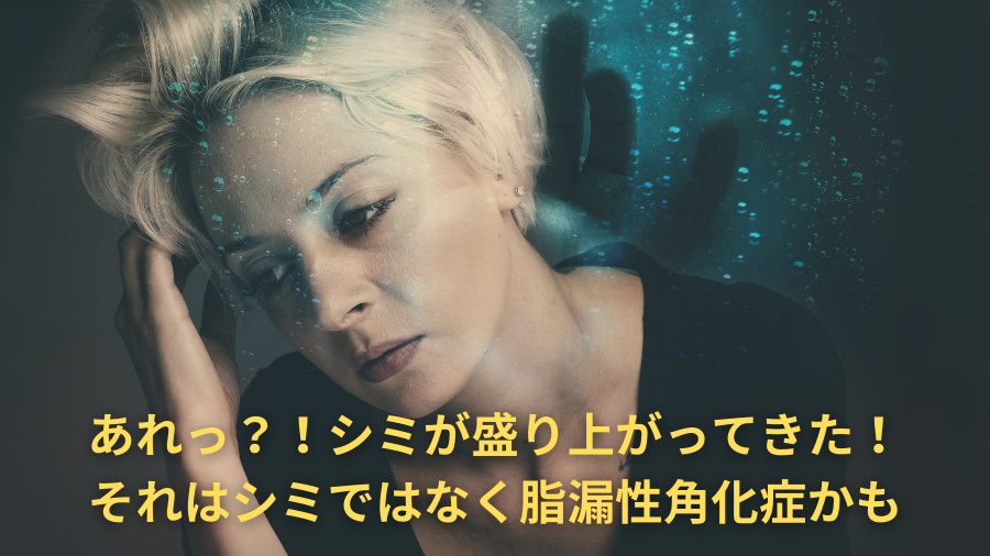 え!?シミが盛り上がってきた。これって本当にシミなの?治療法教えます