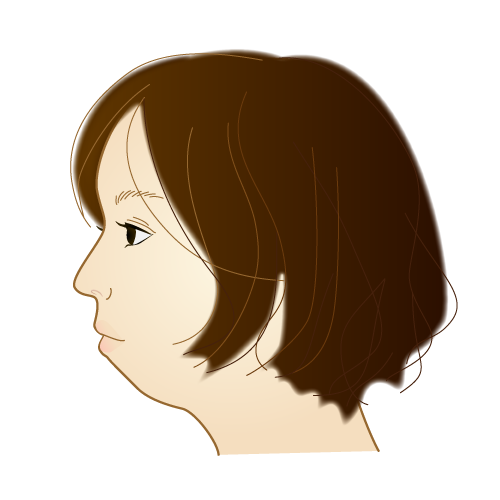 アデノイド顔貌のイラスト 下顎が小さく後退し口元が突出して見える横顔