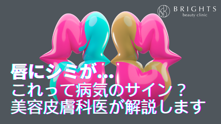 唇にシミが、、、これって病気のサイン？取れるの？さいたま市浦和の美容皮膚科医が解説します
