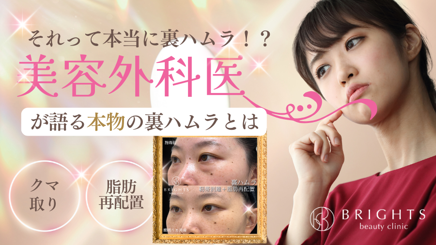 それって本当に裏ハムラ！？美容外科専門医が語る本物の裏ハムラとは