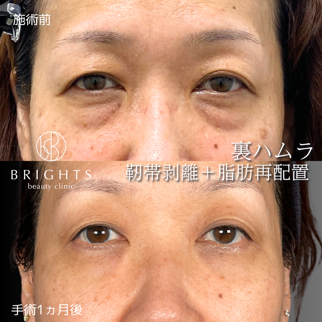 施術前・施術後