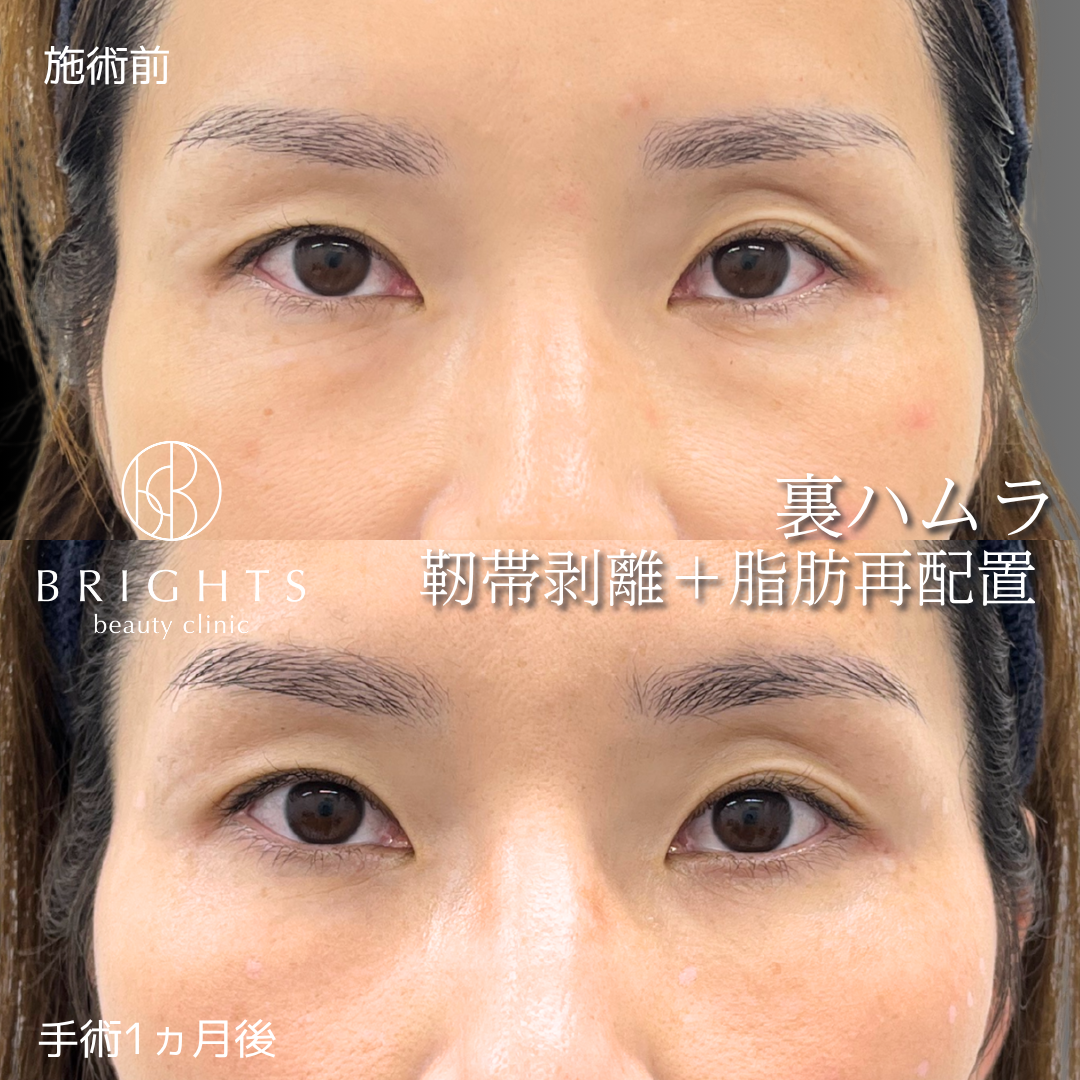 施術前・施術後