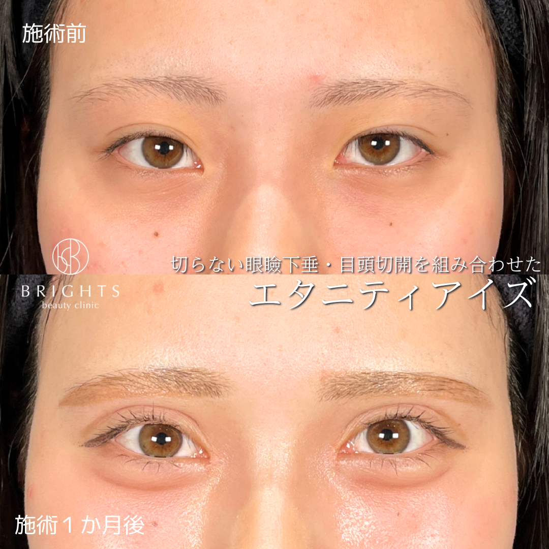 施術前・施術後