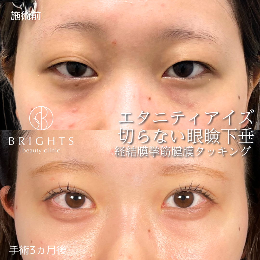 施術前・施術後