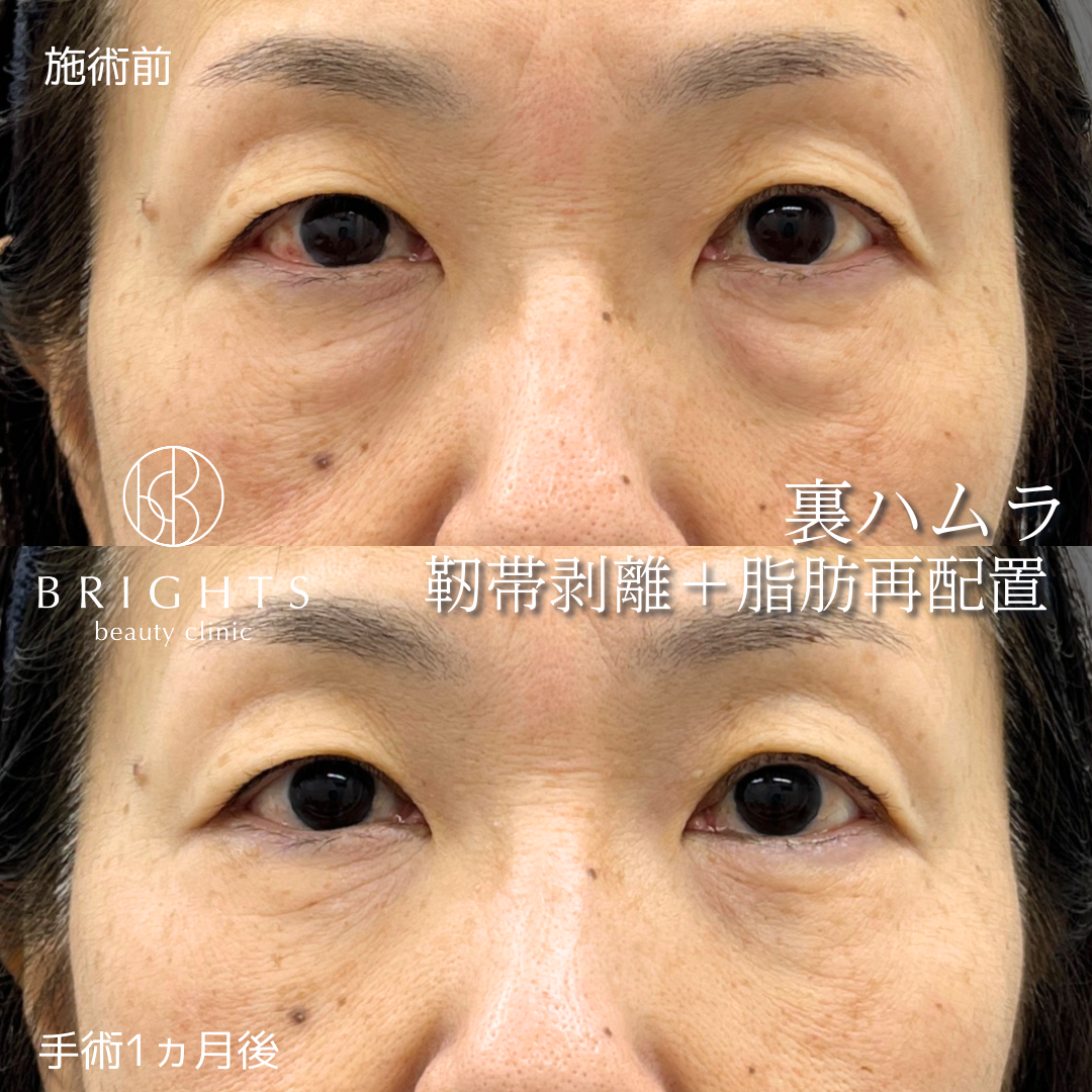 施術前・施術後