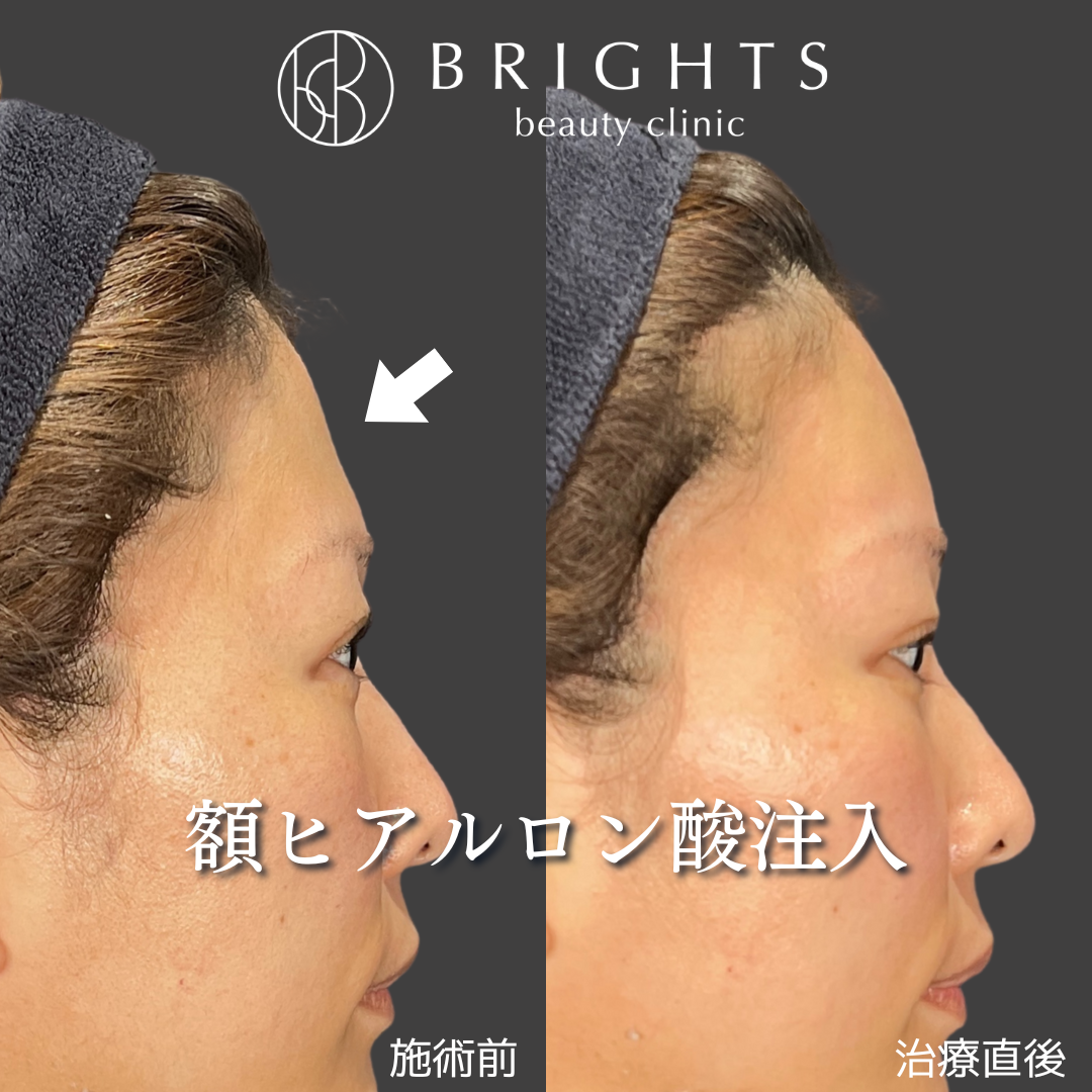 施術前・施術後