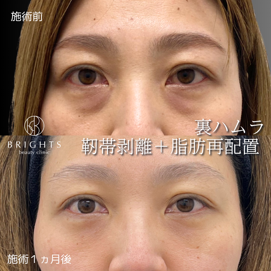 施術前・施術後