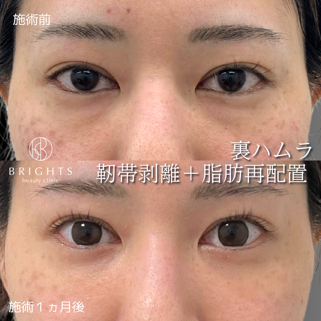 施術前・施術後