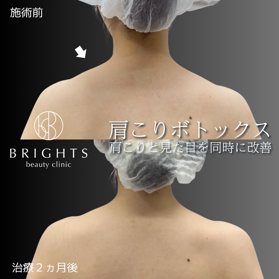 施術前・施術後