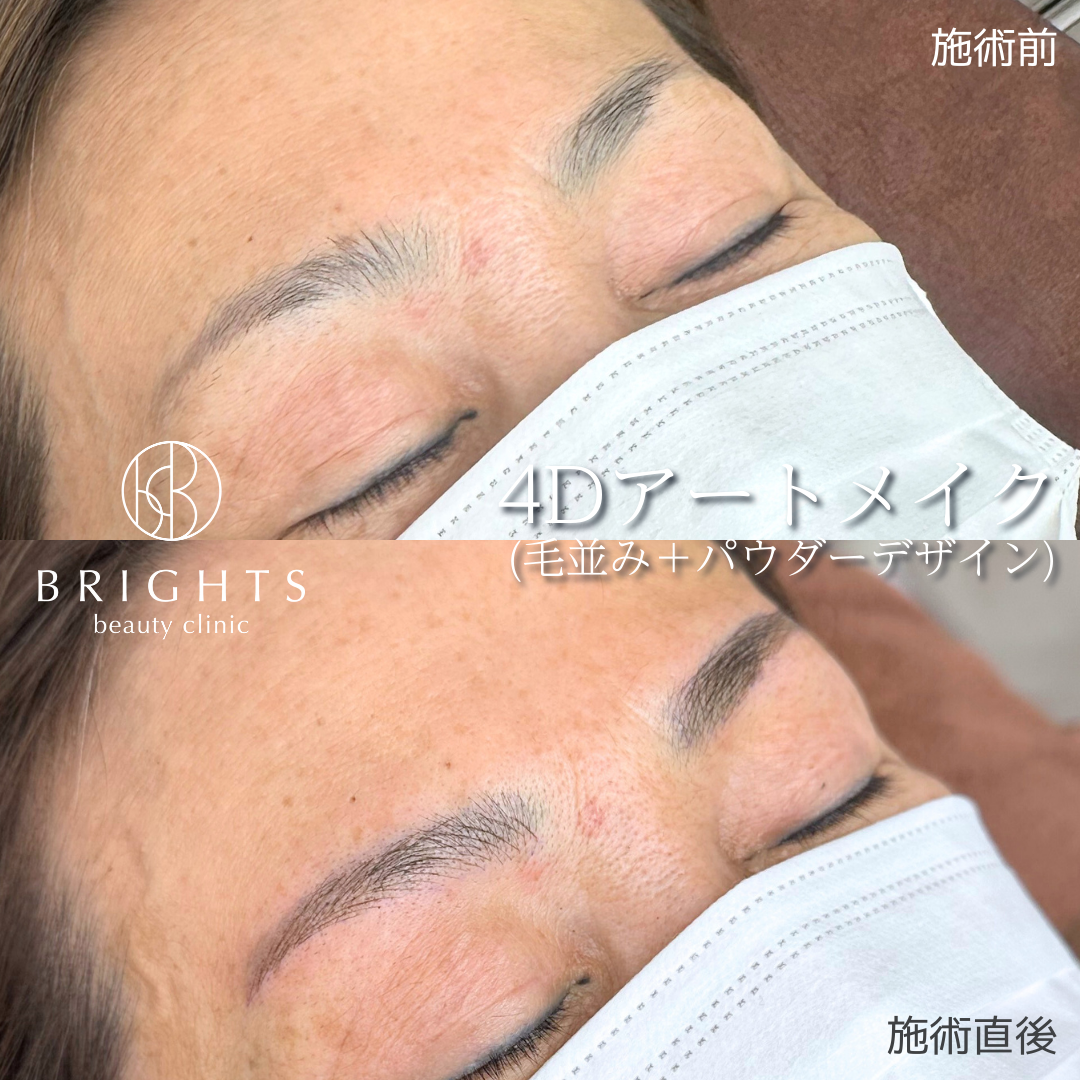 施術前・施術後