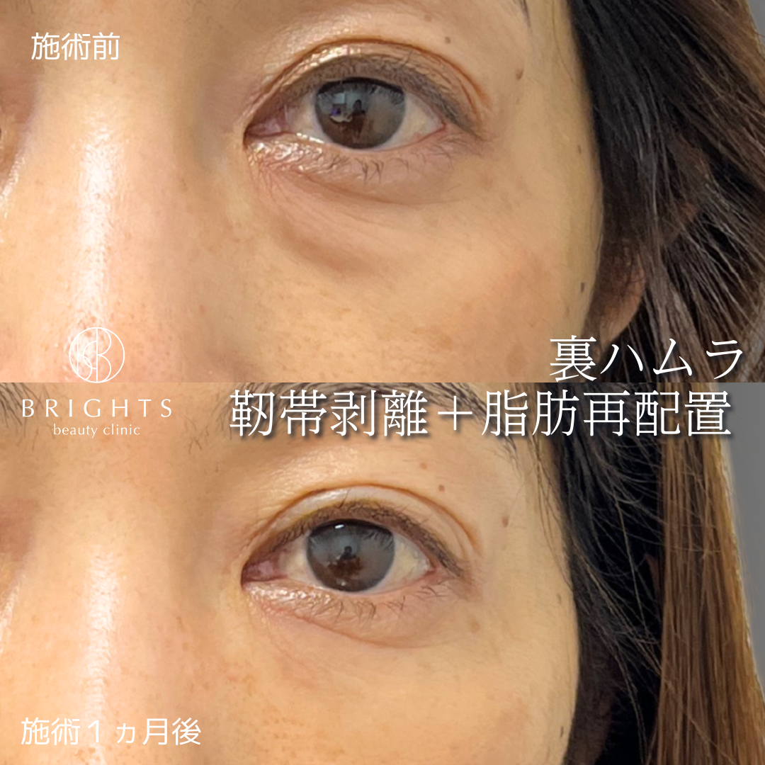 施術前・施術後