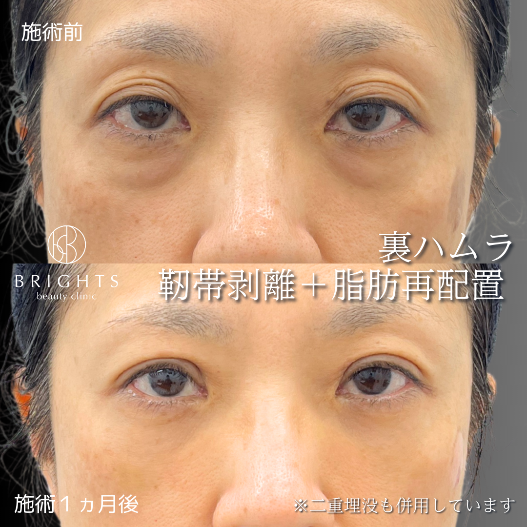 施術前・施術後