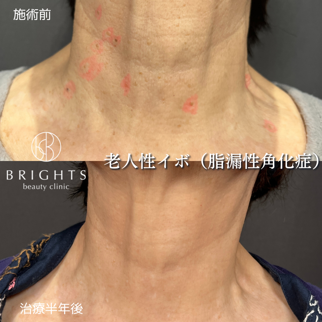 施術前・施術後