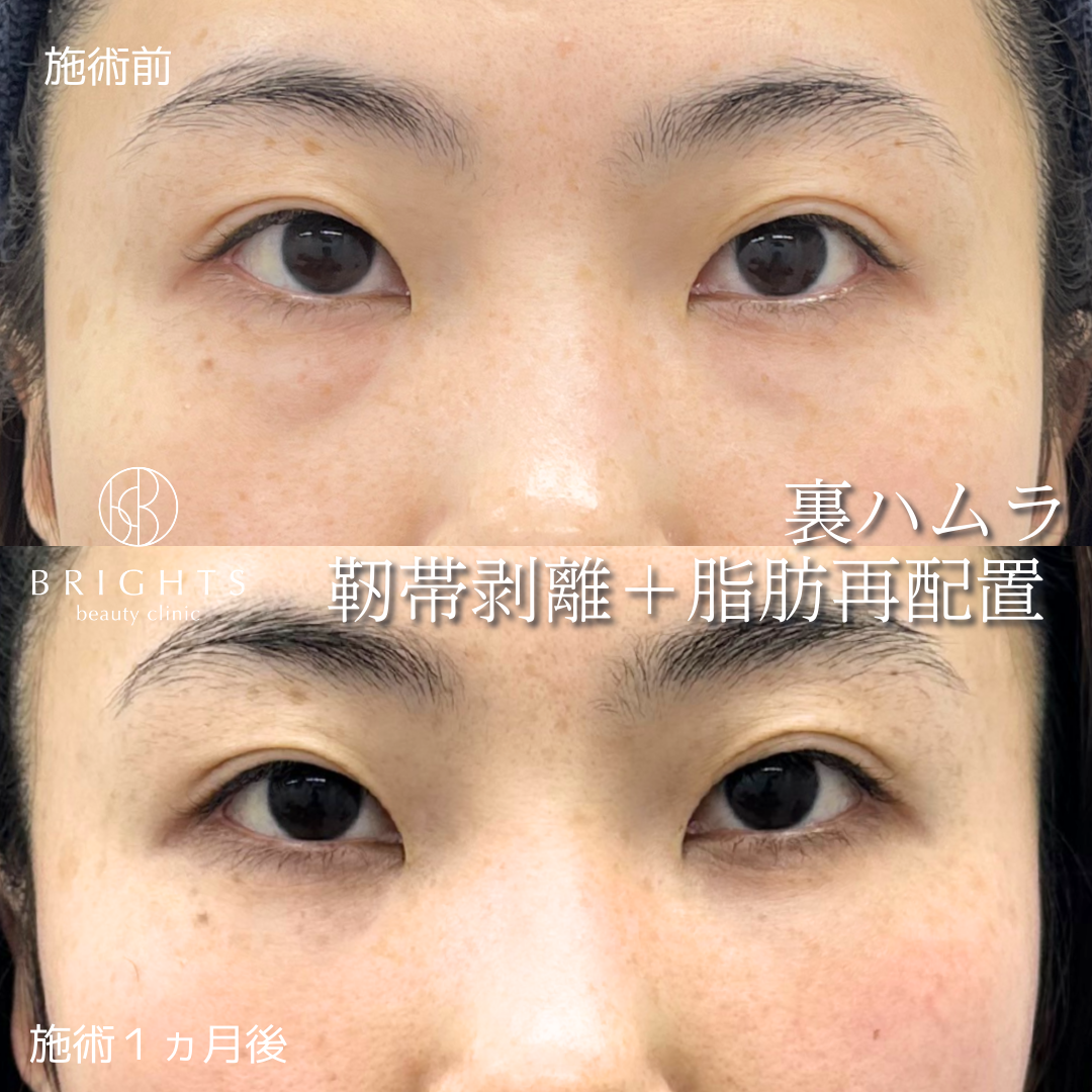 施術前・施術後