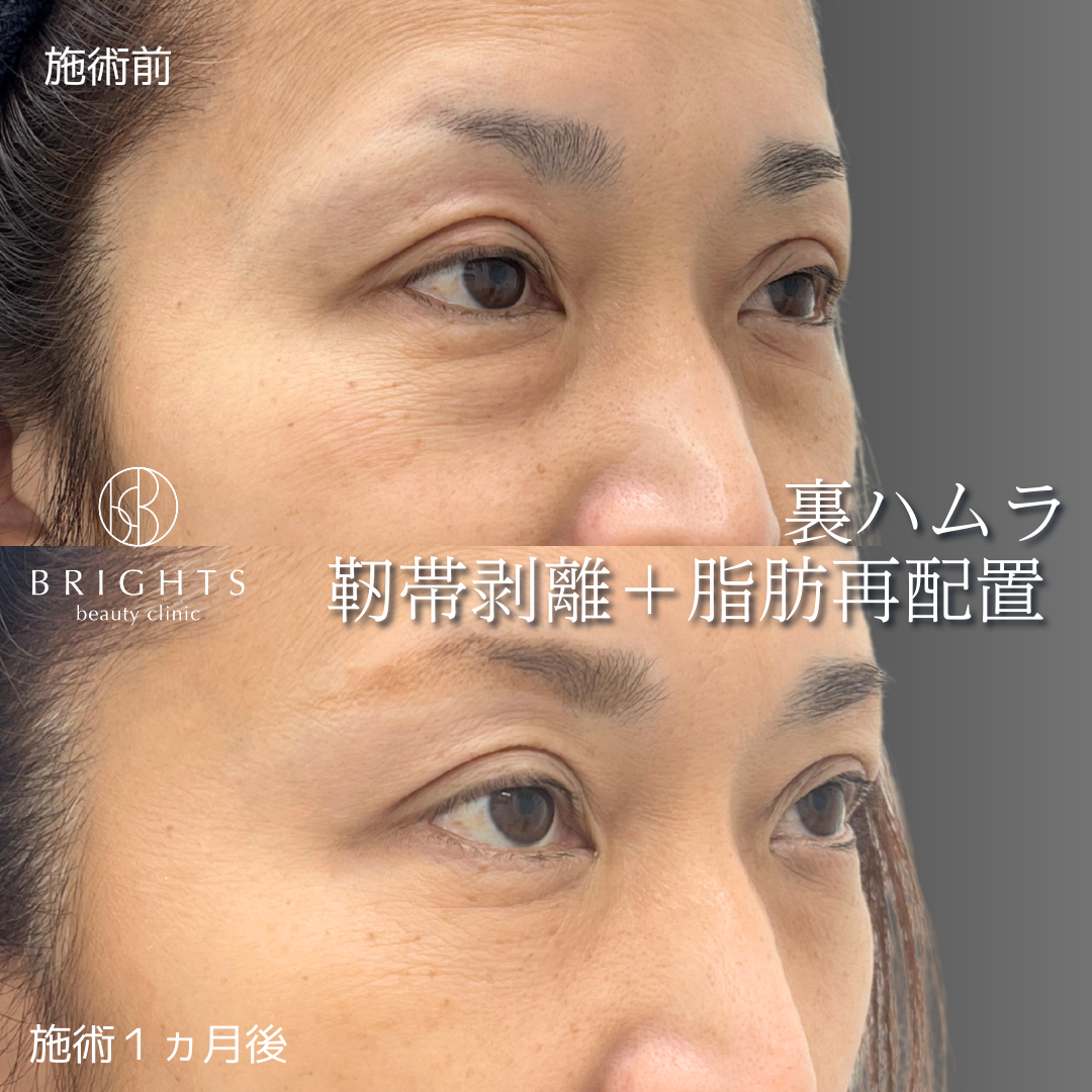 施術前・施術後