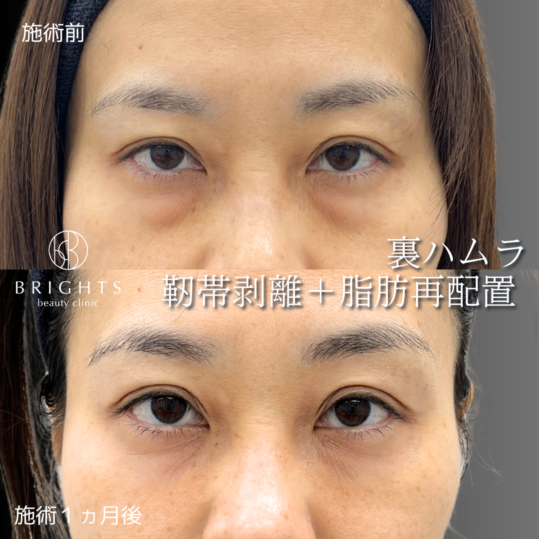 施術前・施術後