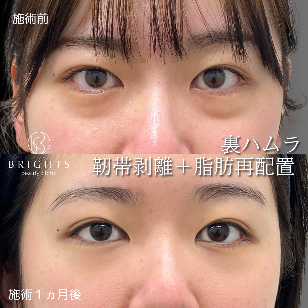 施術前・施術後