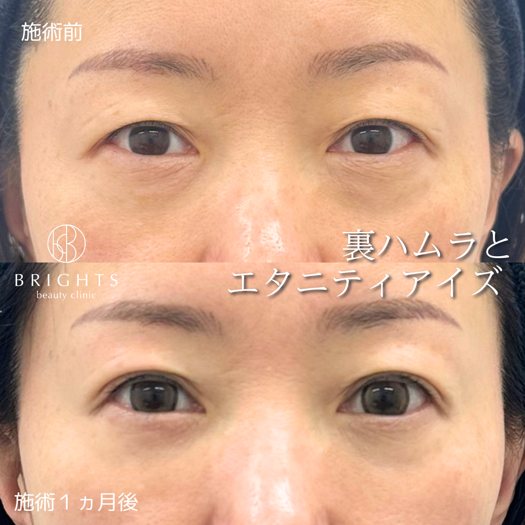 施術前・施術後