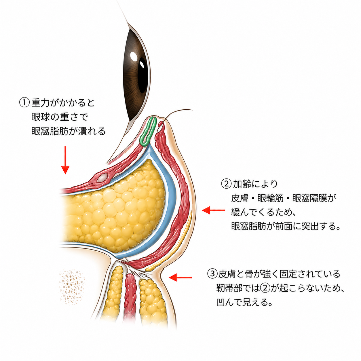 しくみ図・術前