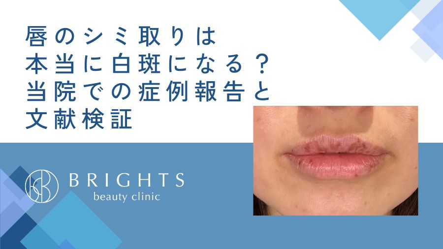 唇のシミ取りは本当に白斑になる？当院での症例報告と文献検証