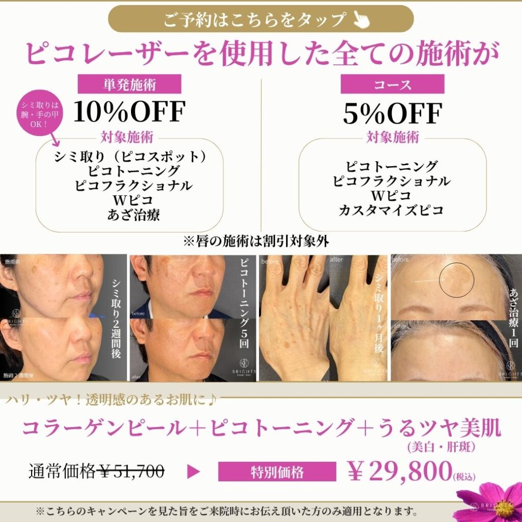 2026年10月 ピコレーザー単発10％OFF・コース5％OFF・美肌セットキャンペーン