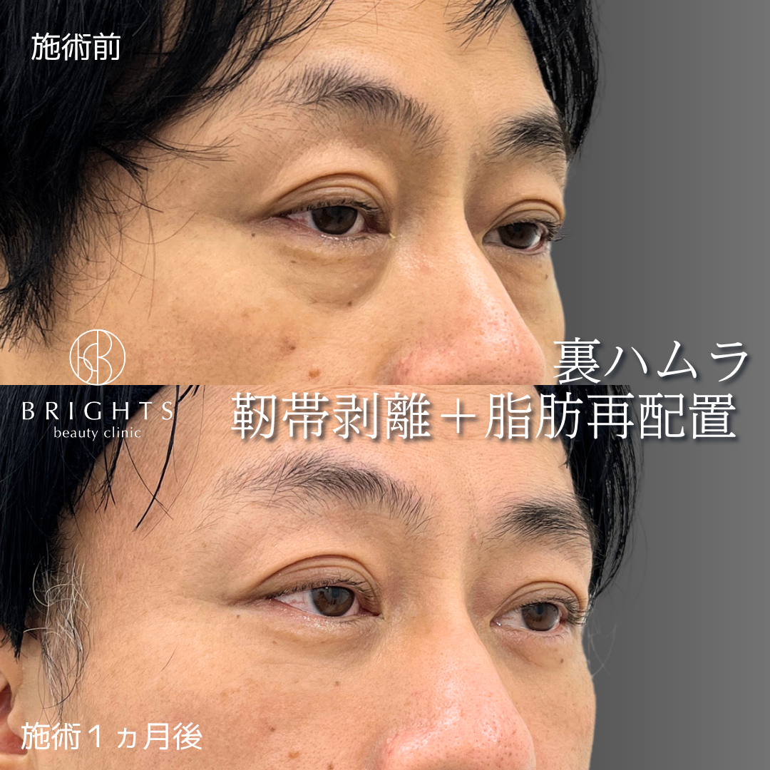 施術前・施術後